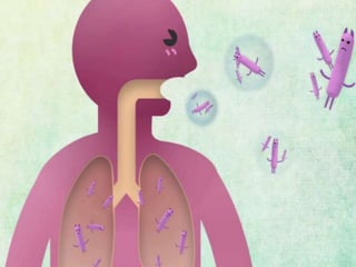 Cutaneous Tuberculosis