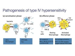 Cutaneous Tuberculosis