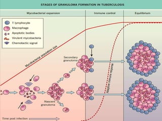 Cutaneous Tuberculosis