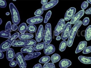 Cutaneous Tuberculosis