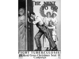 Cutaneous Tuberculosis