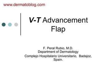 www.dermatoblog.com



           V-T Advancement
                 Flap

                    F. Peral Rubio, M.D.
                 Department of Dermatology
         Complejo Hospitalario Universitario, Badajoz,
                           Spain.
 