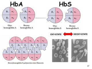 HbA HbS
OXY-STATE DEOXY-STATE
17
 