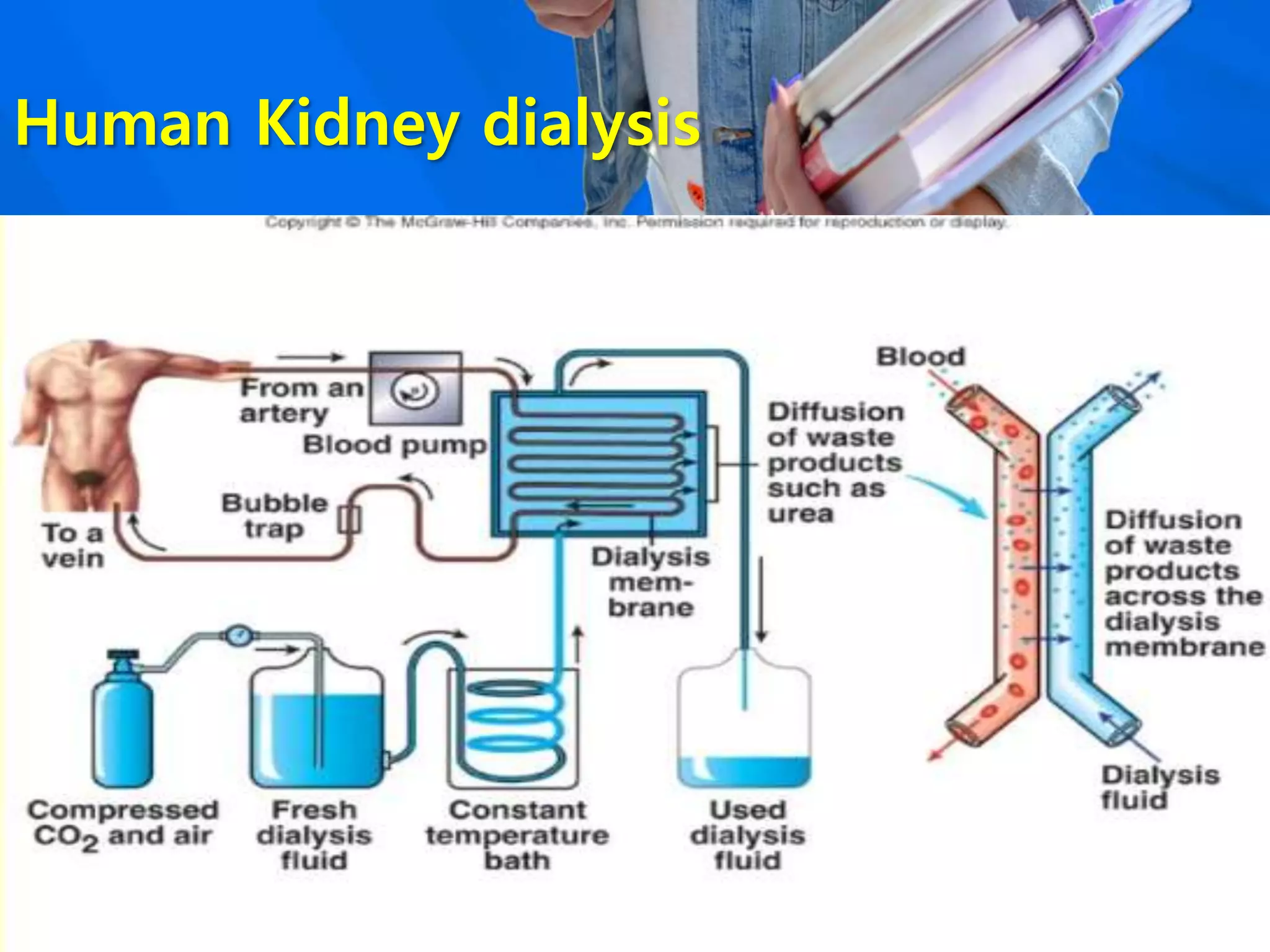 Human Kidney dialysis
 