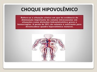 FWAE avaliação unidade 4 - Curso de Choque | PPTX