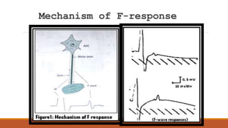 Presentation about late responses f wave h reflex.ppt