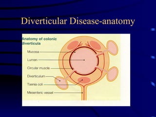 Diverticular Disease-anatomy