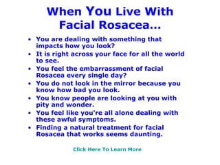 When  You  Live With Facial Rosacea… ,[object Object],[object Object],[object Object],[object Object],[object Object],[object Object],[object Object],[object Object]