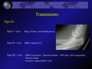 Tratamiento: Tipo IV: Tipo I + Lux:  Sling 14 días y movilidad precoz.  Tipo II + Lux:  ORIF, reparar LCL. Tipo III + Lux:  ORIF en jóvenes  (Sanchez-Sotelo;  90% bien, 20% migración) Prótesis radial Excisión  cabeza.(MCL=ok) 