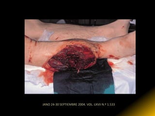 JANO 24-30 SEPTIEMBRE 2004. VOL. LXVII N.º 1.533
 