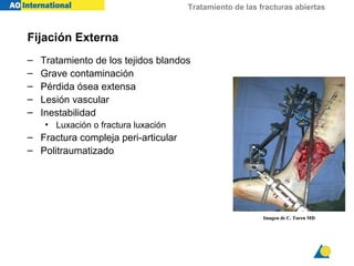 Tratamiento de las fracturas abiertas



Fijación Externa
–   Tratamiento de los tejidos blandos
–   Grave contaminación
–   Pérdida ósea extensa
–   Lesión vascular
–   Inestabilidad
     • Luxación o fractura luxación
– Fractura compleja peri-articular
– Politraumatizado




                                                          Imagen de C. Turen MD
 