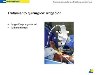 Tratamiento de las fracturas abiertas
Tratamiento quirúrgico: irrigación
– Irrigación por gravedad
– Mínimo 6 litros
 