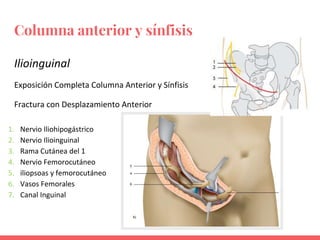 Columna anterior y sínfisis
Ilioinguinal
Exposición Completa Columna Anterior y Sínfisis
Fractura con Desplazamiento Anterior
1. Nervio Iliohipogástrico
2. Nervio Ilioinguinal
3. Rama Cutánea del 1
4. Nervio Femorocutáneo
5. iliopsoas y femorocutáneo
6. Vasos Femorales
7. Canal Inguinal
 