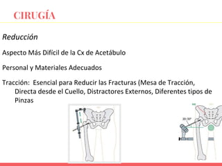 Reducción
Aspecto Más Difícil de la Cx de Acetábulo
Personal y Materiales Adecuados
Tracción: Esencial para Reducir las Fracturas (Mesa de Tracción,
Directa desde el Cuello, Distractores Externos, Diferentes tipos de
Pinzas
CIRUGÍA
 