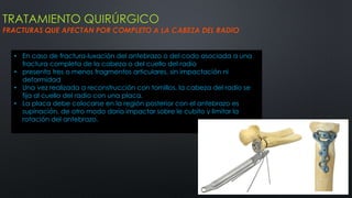 TRATAMIENTO QUIRÚRGICO
FRACTURAS QUE AFECTAN POR COMPLETO A LA CABEZA DEL RADIO
• En caso de fractura-luxación del antebrazo o del codo asociada a una
fractura completa de la cabeza o del cuello del radio
• presenta tres o menos fragmentos articulares, sin impactación ni
deformidad
• Una vez realizada a reconstrucción con tornillos, la cabeza del radio se
fija al cuello del radio con una placa.
• La placa debe colocarse en la región posterior con el antebrazo es
supinación, de otro modo doria impactar sobre le cubito y limitar la
rotación del antebrazo.
 
