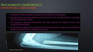 TRATAMIENTO QUIRÚRGICO
EXTIRPACIÓN DE LA CABEZA DE RADIO
• Raramente está indicada en las lesiones aisladas en fase aguda
• En general los pacientes tienen pocos síntomas, dolor ocasional leve y un rango
de movilidad casi normal,
• La migración proximal sintomática de radio precisa en algunos casos una
sinostosis radiocubital
• En las fracturas de tipo II y II de Mason la escisión tardía consigue unos resultados
buenos a excelentes en el 80% de los casos.
 