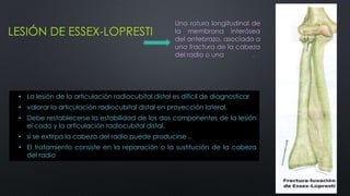 LESIÓN DE ESSEX-LOPRESTI
• La lesión de la articulación radiocubital distal es difícil de diagnosticar
• valorar la articulación radiocubital distal en proyección lateral.
• Debe restablecerse la estabilidad de los dos componentes de la lesión
el codo y la articulación radiocubital distal.
• si se extirpa la cabeza del radio puede producirse ..
• El tratamiento consiste en la reparación o la sustitución de la cabeza
del radio
Una rotura longitudinal de
la membrana interósea
del antebrazo, asociada a
una fractura de la cabeza
del radio o una .
 