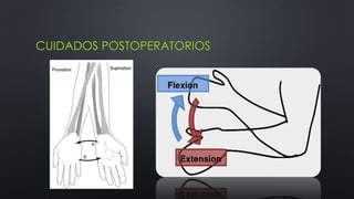 CUIDADOS POSTOPERATORIOS
 