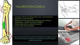 VALORACIÓN CLÍNICA
• Limitación de la movilidad del codo y del antebrazo.
• DOLOR A LA PALPACION
• Explorar porción distal del antebrazo y la muñeca
ipsilaterales.- LESIÓN DE ESSEX-LOPRESTI
• Valorar ligamentos colateral medial.
• Evacuación del hemartros.
fractura-luxación de la cabeza del radio asociado a rotura
de la membrana interósea con lesión de la articulación
radiocubital distal
 