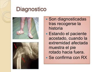 Diagnostico
           Son diagnosticadas
            tras recogerse la
            historia
           Estando el paciente
            acostado, cuando la
            extremidad afectada
            muestra el pie
            rotado hacia fuera.
           Se confirma con RX
 