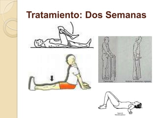 Tratamiento: Dos Semanas
 