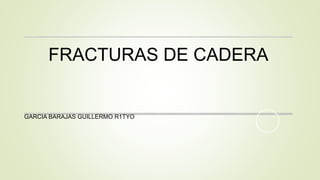 GARCIA BARAJAS GUILLERMO R1TYO
FRACTURAS DE CADERA
 