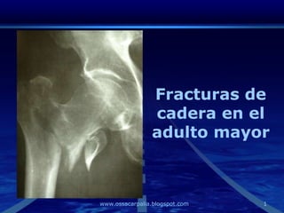 Fracturas de
                cadera en el
                adulto mayor



www.ossacarpalia.blogspot.com   1
 