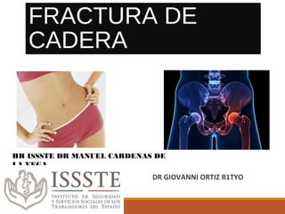 FRACTURA DE
CADERA
DR GIOVANNI ORTIZ R1TYO
HR ISSSTE DR MANUEL CARDENAS DE
LA VEGA
 