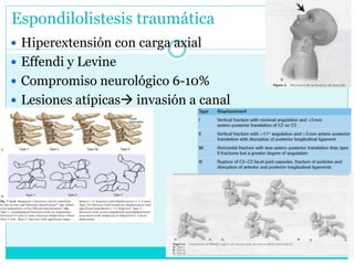 Fx cervicales r3 final | PPT
