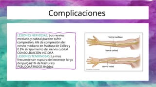 Presentación Fractura de colles y smith.pptx