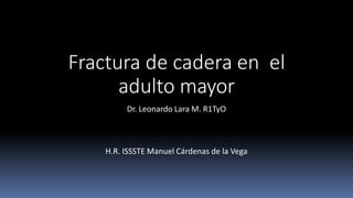 Fractura de cadera en el
adulto mayor
Dr. Leonardo Lara M. R1TyO
H.R. ISSSTE Manuel Cárdenas de la Vega
 