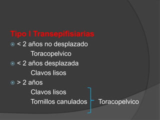 Tipo I Transepifisiarias
 < 2 años no desplazado
Toracopelvico
 < 2 años desplazada
Clavos lisos
 > 2 años
Clavos lisos
Tornillos canulados Toracopelvico
 