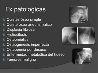 Fx patologicas
 Quistes óseo simple
 Quiste óseo aneurismático
 Displasia fibrosa
 Histiocitosis
 Osteomielitis
 Osteogénesis imperfecta
 Osteopenia por desuso
 Enfermedad metabólica del hueso
 Tumores maligno
 