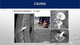 • ACTOS DE VIOLENCIA 15-20%
CAUSAS
 