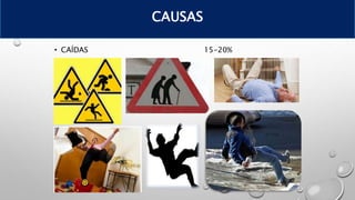 • CAÍDAS 15-20%
CAUSAS
 
