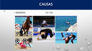 • DEPORTES 10-15%
CAUSAS
 