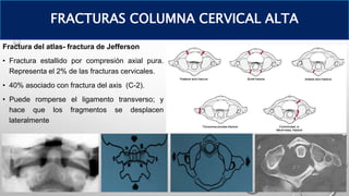 Fractura del atlas- fractura de Jefferson
• Fractura estallido por compresión axial pura.
Representa el 2% de las fracturas cervicales.
• 40% asociado con fractura del axis (C-2).
• Puede romperse el ligamento transverso; y
hace que los fragmentos se desplacen
lateralmente
FRACTURAS COLUMNA CERVICAL ALTA
 