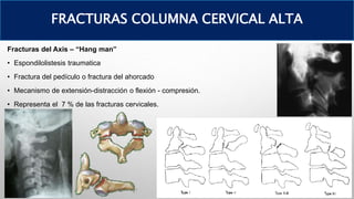 Fracturas del Axis – “Hang man”
• Espondilolistesis traumatica
• Fractura del pedículo o fractura del ahorcado
• Mecanismo de extensión-distracción o flexión - compresión.
• Representa el 7 % de las fracturas cervicales.
FRACTURAS COLUMNA CERVICAL ALTA
 