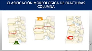 CLASIFICACIÓN MORFOLÓGICA DE FRACTURAS
COLUMNA
 