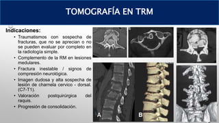 Indicaciones:
• Traumatismos con sospecha de
fracturas, que no se aprecian o no
se pueden evaluar por completo en
la radiología simple.
• Complemento de la RM en lesiones
medulares.
• Fractura inestable / signos de
compresión neurológica.
• Imagen dudosa y alta sospecha de
lesión de charnela cervico - dorsal.
(C7-T1).
• Valoración postquirúrgica del
raquis.
• Progresión de consolidación.
TOMOGRAFÍA EN TRM
 