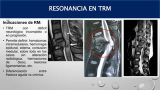 Indicaciones de RM:
• TRM con déficit
neurológico incompleto o
en progresión.
• Permite definir: hematomas
intramedulares, hemorragia
epidural, edema, contusión
medular, sobre todo en los
casos sin alteración
radiológica, herniaciones
de disco, lesiones
ligamentarias, etc.
• Diferenciación entre
fractura aguda vs crónica.
RESONANCIA EN TRM
 