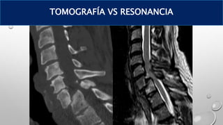 TOMOGRAFÍA VS RESONANCIA
 