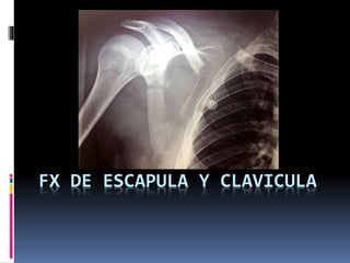FX DE ESCAPULA Y CLAVICULA
 