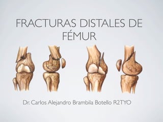 FRACTURAS DISTALES DE
       FÉMUR




 Dr. Carlos Alejandro Brambila Botello R2TYO
 