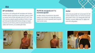 Fx de humero, codo y triada terrible.pptx