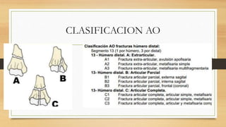 CLASIFICACION AO
 