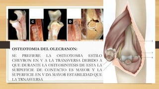 OSTEOTOMIA DEL OLECRANON:
SE PREFIERE LA OSTEOTOMIA ESTILO
CHEVRON EN V A LA TRANSVERSA DEBIDO A
QUE DURANTE LA OSTEOSINTESIS DE ESTA LA
SURPEFICIE DE CONTACTO ES MAYOR Y LA
SUPERFICIE EN V DA MAYOR ESTABILIDAD QUE
LA TRNASVERSA
 