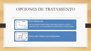 OPCIONES DE TRATAMIENTO
 