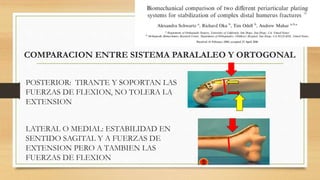 COMPARACION ENTRE SISTEMA PARALALEO Y ORTOGONAL
POSTERIOR: TIRANTE Y SOPORTAN LAS
FUERZAS DE FLEXION, NO TOLERA LA
EXTENSION
LATERAL O MEDIAL: ESTABILIDAD EN
SENTIDO SAGITAL Y A FUERZAS DE
EXTENSION PERO A TAMBIEN LAS
FUERZAS DE FLEXION
 