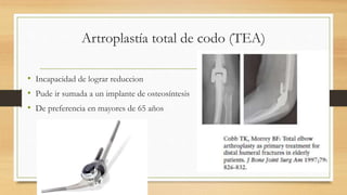 Artroplastía total de codo (TEA)
• Incapacidad de lograr reduccion
• Pude ir sumada a un implante de osteosíntesis
• De preferencia en mayores de 65 años
 